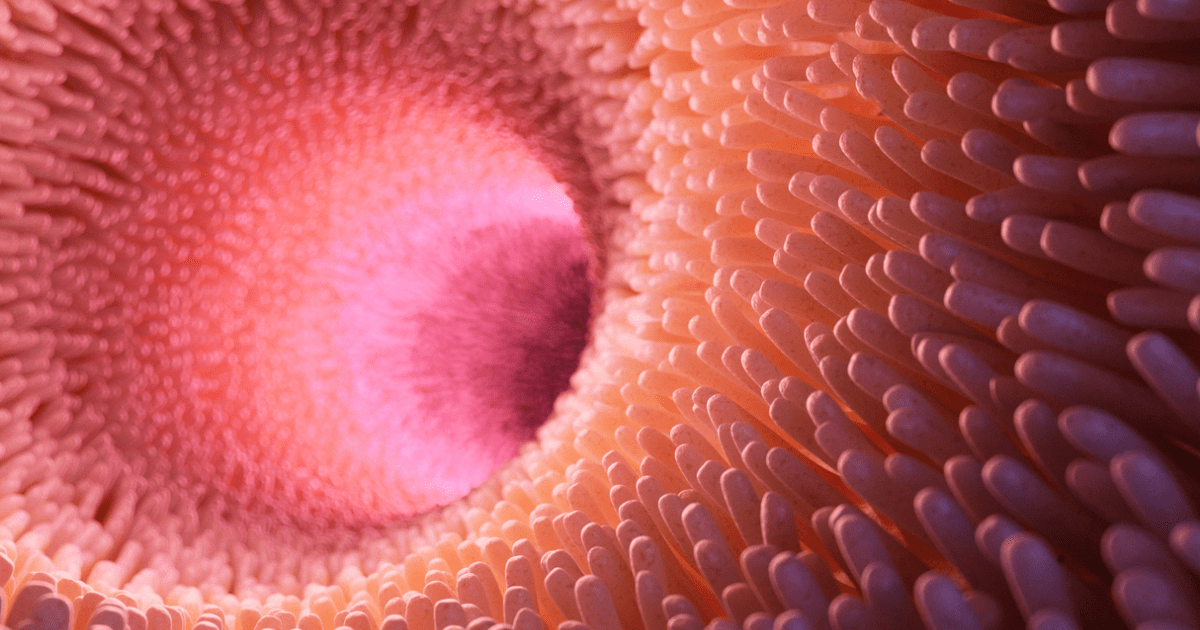 Le lavement intestinal Xantis